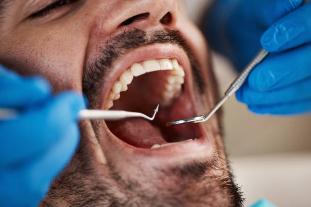 Best Emergency Root Canal Treatment in Creedmoor, NC
